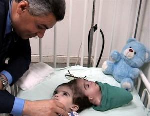 lthumb.xhj10902211747.egypt_separation_surgery_xhj109.jpeg